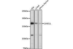 Western blot analysis of extracts of various cell lines, using C antibody (ABIN6127550, ABIN6137939, ABIN6137940 and ABIN6222956) at 1:1000 dilution. (CARD11 抗体  (AA 985-1154))