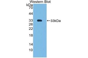 Western blot analysis of the recombinant protein. (SMAD6 抗体  (AA 171-441))