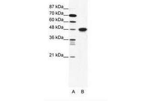Image no. 1 for anti-Enolase 1 (ENO1) (N-Term) antibody (ABIN202517) (ENO1 抗体  (N-Term))
