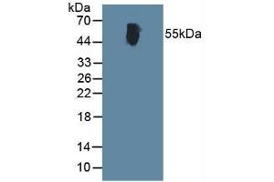 Western blot analysis of Human Blood Cells. (ALT 抗体  (AA 367-480))