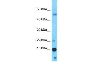 Host:  Rabbit  Target Name:  PAGE4  Sample Type:  Thymus Tumor lysates  Antibody Dilution:  1. (PAGE4 抗体  (N-Term))