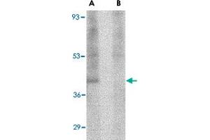 Western blot analysis of RIMS3 in human brain tissue lysate with RIMS3 polyclonal antibody  at 1 ug/mL in the (A) absence and (B) presence of blocking peptide. (RIMS3 抗体  (N-Term))