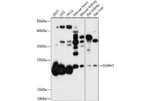 Western blot analysis of extracts of various cell lines, using DNPH1 antibody (ABIN7266384) at 1:1000 dilution. (RCL 抗体  (AA 1-174))