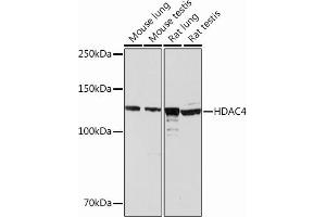 Western blot analysis of extracts of various cell lines, using HD Rabbit mAb (ABIN6132653, ABIN6147718, ABIN6147719 and ABIN7101423) at 1:1000 dilution. (HDAC4 抗体)