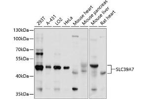 Western blot analysis of extracts of various cell lines, using SLC39 antibody (ABIN1682785, ABIN3017729, ABIN3017730 and ABIN6220217) at 1:1000 dilution. (SLC39A7 抗体  (AA 235-380))