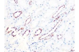 Immunohistochemistry of paraffin-embedded rat kidney using PDHB Rabbit mAb (ABIN7269772) at dilution of 1:100 (40x lens). (PDHB 抗体)
