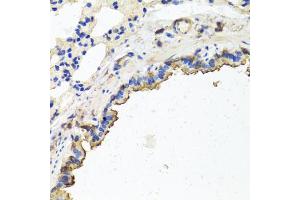 Immunohistochemistry of paraffin-embedded rat lung using TUBB8 antibody (ABIN5974843) at dilution of 1/100 (40x lens). (Tubulin, beta 8 抗体)