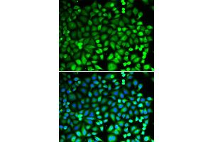 Immunofluorescence analysis of MCF-7 cells using PSMB2 antibody (ABIN6291444). (PSMB2 抗体)