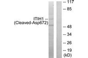 Western blot analysis of extracts from Jurkat cells, treated with etoposide 25uM 24h, using ITIH1 (Cleaved-Asp672) Antibody. (ITIH1 抗体  (Cleaved-Asp672))