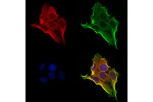 ABIN6260791 and ABIN6273208 staining Hela cells by IF/ICC.