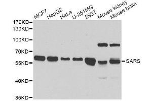 Western blot analysis of extracts of various cell lines, using SARS antibody. (Seryl-tRNA Synthetase (SARS) (AA 1-300) 抗体)