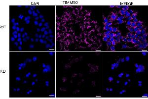 Immunocytochemical staining of HeLa cells using TIMM50 antibody (ABIN7800615), 1:1,000), Top panel: wild-type (WT), Bottom panal: TIMM50 shRNA knockdown (KD).