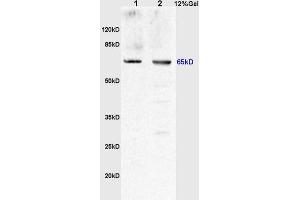SDS-PAGE (SDS) image for anti-Uromodulin (UMOD) (AA 351-450) antibody (ABIN678473)
