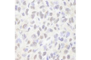 Immunohistochemistry (IHC) image for anti-PDS5, Regulator of Cohesion Maintenance, Homolog B (PDS5B) (AA 1200-1250) antibody (ABIN7448998)