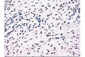 Immunohistochemical staining of paraffin-embedded colon tissue using anti-BRAFmouse monoclonal antibody. (BRAF 抗体)