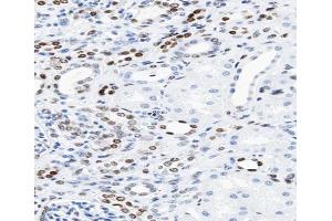 ABIN6266610 at 1/100 staining human kidney tissue sections by IHC-P. (KAT2B 抗体  (C-Term))