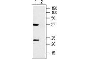 Western blot analysis of rat skeletal muscle lysate: - 1. (CACNG1 抗体  (1st Extracellular Loop))