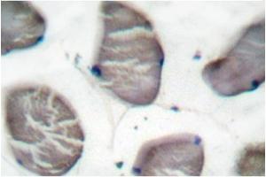 Image no. 1 for anti-Actin, alpha 1, Skeletal Muscle (ACTA1) antibody (ABIN265299) (Actin 抗体)