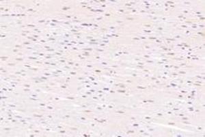 Immunohistochemistry analysis of paraffin-embedded rat heart using,SRFBP1 (ABIN7075579) at dilution of 1: 2000