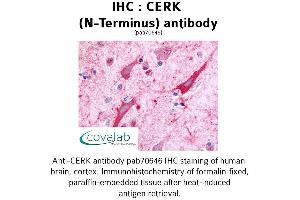 Image no. 1 for anti-Ceramide Kinase (CERK) (Extracellular Domain), (N-Term) antibody (ABIN1733020) (CERK 抗体  (Extracellular Domain, N-Term))