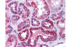 Immunohistochemistry (IHC) image for anti-Tumor Protein P53 (TP53) (N-Term) antibody (ABIN2779317) (p53 抗体  (N-Term))
