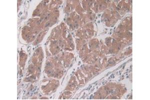 DAB staining on IHC-P Samples:Human Stomach Tissue) (PAI1 抗体  (AA 25-402))