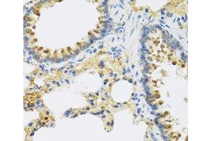 Immunohistochemistry of paraffin-embedded Rat lung using HRG Polyclonal Antibody at dilution of 1:100 (40x lens). (HRG 抗体)