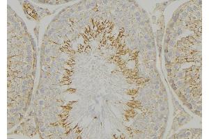 ABIN6269155 at 1/100 staining Mouse testis tissue by IHC-P. (VAV1 抗体  (N-Term))