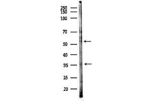 anti-BEN Domain Containing 4 (BEND4) (Internal Region) antibody