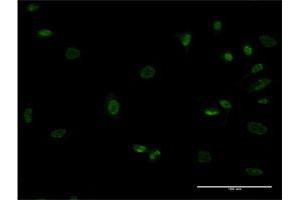 Immunofluorescence of monoclonal antibody to MEOX1 on HeLa cell. (MEOX1 抗体  (AA 82-170))