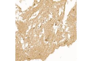 Immunohistochemistry of paraffin-embedded human brain using RC Rabbit pAb (ABIN6129452, ABIN6146811, ABIN6146812 and ABIN6220955) at dilution of 1:150 (40x lens). (RCAN1 抗体  (AA 60-245))