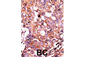 Immunohistochemistry (IHC) image for anti-LPR1 (pSer4520) antibody (ABIN3001761) (LPR1 (pSer4520) 抗体)
