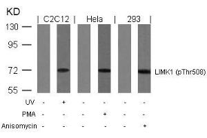 Western blot analysis of extracts from UV-treated C2C12, PMA-treated Hela and anisomycin-treated 293 cells using LIMK1(Phospho-Thr508) Antibody. (LIM Domain Kinase 1 抗体  (pThr508))