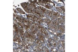 Immunohistochemical staining (Formalin-fixed paraffin-embedded sections) of human stomach with CYP4F11 polyclonal antibody  shows strong cytoplasmic and membranous positivity in glandular cells. (CYP4F11 抗体)