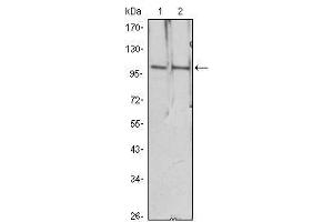 Western Blot showing HDAC4 antibody used against Hela (1), Jurkat (2) cell lysate. (HDAC4 抗体)
