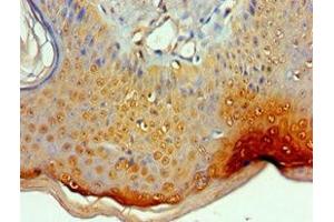 Immunohistochemistry of paraffin-embedded human skin tissue using ABIN7156454 at dilution of 1:100 (ITGA9 抗体  (AA 30-250))