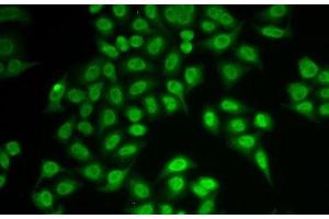 Immunofluorescence analysis of MCF-7 cells using PSMB9 Polyclonal Antibody (PSMB9 抗体)