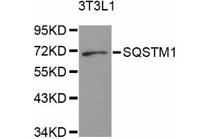 Western blot analysis of extracts of 3T3-L1 cells, using SQSTM1 antibody. (SQSTM1 抗体)