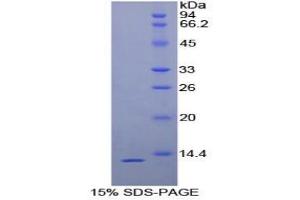 SDS-PAGE analysis of Human uPAR Protein. (PLAUR 蛋白)