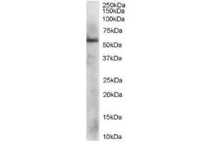 Image no. 1 for anti-Protein Disulfide Isomerase Family A, Member 3 (PDIA3) (C-Term) antibody (ABIN374286) (PDIA3 抗体  (C-Term))