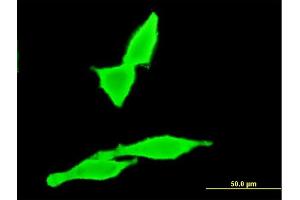 Immunofluorescence of monoclonal antibody to CNR2 on HeLa cell. (CNR2 抗体  (AA 302-360))