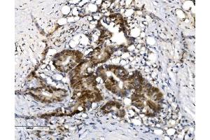 IHC analysis of VPRBP/DCAF1 using anti-VPRBP/DCAF1 antibody (ABIN7599063). (DDB1 and CUL4-Associated Factor 1 (DCAF1) (AA 1-195) 抗体)