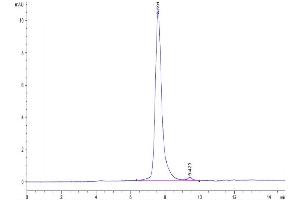 Fibroblast Growth Factor 21 (FGF21) (AA 29-209) protein (His tag)