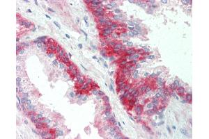 Anti-SGPP1 antibody IHC staining of human prostate. (SGPP1 抗体  (AA 13-42))