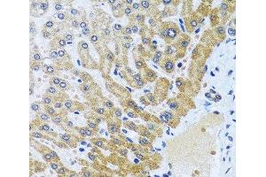 Immunohistochemistry of paraffin-embedded Human liver using CPA6 Polyclonal Antibody at dilution of 1:100 (40x lens). (CPA6 抗体)