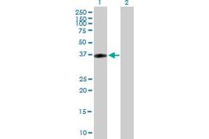 Western Blot analysis of CRHR2 expression in transfected 293T cell line by CRHR2 MaxPab polyclonal antibody. (CRHR2 抗体  (AA 1-411))