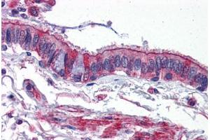 Immunohistochemistry (IHC) image for anti-Activin A Receptor, Type IB (ACVR1B) (C-Term) antibody (ABIN1099822)
