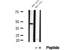 Western blot analysis of extracts of mouse testis tissue, using BBS5 antibody.
