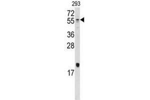 Image no. 1 for anti-Bone Morphogenetic Protein 10 (BMP10) (N-Term) antibody (ABIN357176) (BMP10 抗体  (N-Term))