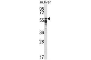 Western blot analysis of PPP2R5A Antibody (C-term) in mouse liver tissue lysates (35ug/lane). (PPP2R5A 抗体  (C-Term))